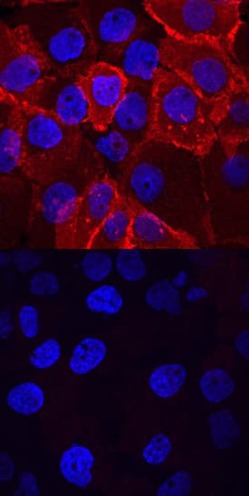 Human Phospho-Insulin R (Y1162/Y1163)/IGF-I R (Y1135/Y1136) Antibody ...