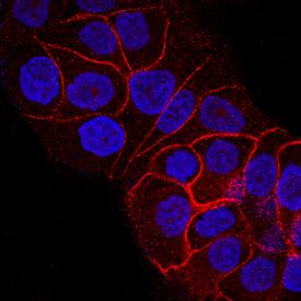 Insulin R/CD220 antibody in RT-4 Human Cell Line by Immunocytochemistry (ICC).