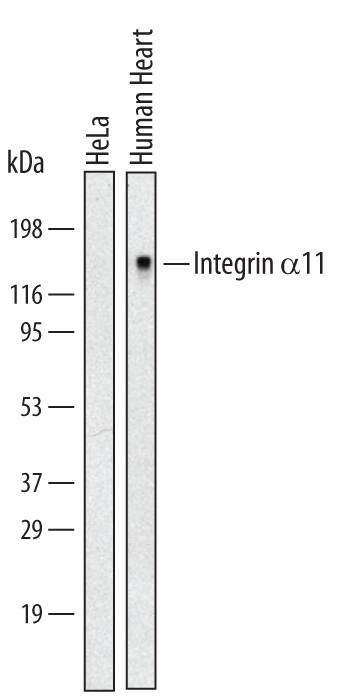 Detection of Human Integrin a11 antibody by Western Blot.