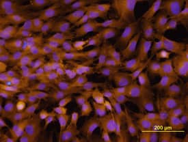 Integrin a2/CD49b antibody in MG-63 Human Cell Line by Immunocytochemistry (ICC).