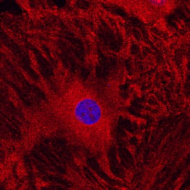 Integrin aV/CD51 antibody in Rat Mesenchymal Stem Cells by Immunocytochemistry (ICC).