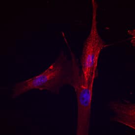Integrin  beta1/CD29 antibody in Canine Mesenchymal Stem Cells by Immunocytochemistry (ICC).