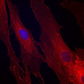 Integrin  beta1/CD29 antibody in Human Mesenchymal Stem Cells by Immunocytochemistry (ICC).