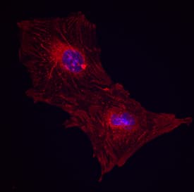 Integrin  beta1/CD29 antibody in Porcine Mesenchymal Stem Cells by Immunocytochemistry (ICC).