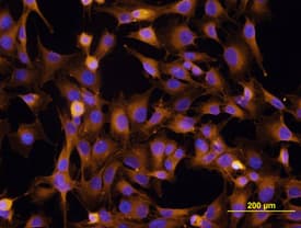 Integrin  beta1/CD29 antibody in MG-63 Human Cell Line by Immunocytochemistry (ICC).