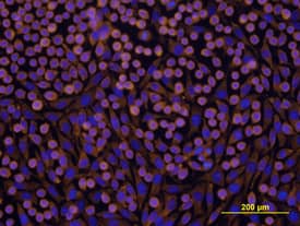 Integrin  beta1/CD29 antibody in L-929 Mouse Cell Line by Immunocytochemistry (ICC).