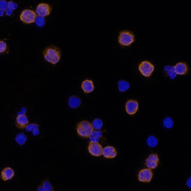 Integrin  beta2/CD18 antibody in Human PBMCs by Immunocytochemistry (ICC).