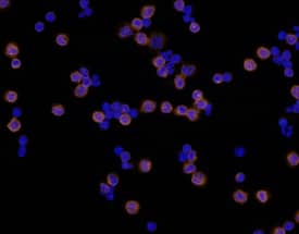 Integrin  beta2/CD18 antibody in Human PBMCs by Immunocytochemistry (ICC).