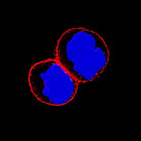 Integrin beta4/CD104 in A431 Human Cell Line. Integrin beta4/CD104 antibody in A431 Human Cell Line by Immunocytochemistry (ICC).