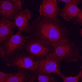 Integrin aV beta5 antibody in HT1080 Human Cell Line by Immunocytochemistry (ICC).