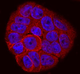 Integrin  beta6 antibody in HT-29 Human Cell Line by Immunocytochemistry (ICC).