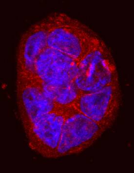 Integrin  beta6 antibody in HT-29 Human Cell Line by Immunocytochemistry (ICC).
