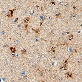 Isocitrate Dehydrogenase 1/IDH1 antibody in Human Brain by Immunohistochemistry (IHC-P).