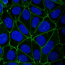 JAM-A antibody in MCF-7 Human Cell Line by Immunocytochemistry (ICC).