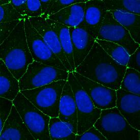 JAM-A antibody in MCF-7 Human Cell Line by Immunocytochemistry (ICC).