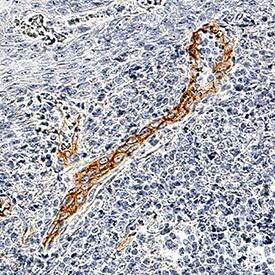 JAM-B/VE-JAM antibody in Human Tonsil by Immunohistochemistry (IHC-P).