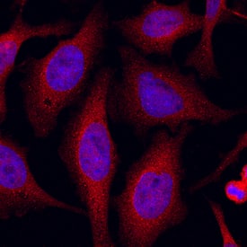 JNK1/JNK2 antibody in HeLa Human Cervical Epithelial Carcinoma Cell Line by Immunocytochemistry (ICC).