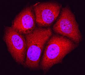 JNK1 antibody in MCF-7 Human Cell Line by Immunocytochemistry (ICC).
