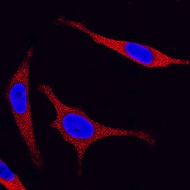 JNK2 in HeLa Human Cell Line. JNK2 antibody in HeLa Human Cell Line by Immunocytochemistry (ICC).