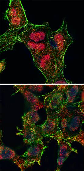 Phospho-JNK (T183/Y185) antibody in HEK293 Human Cell Line by Immunocytochemistry (ICC).