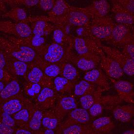 Jade-1/PHF17 antibody in HeLa Human Cell Line by Immunocytochemistry (ICC).