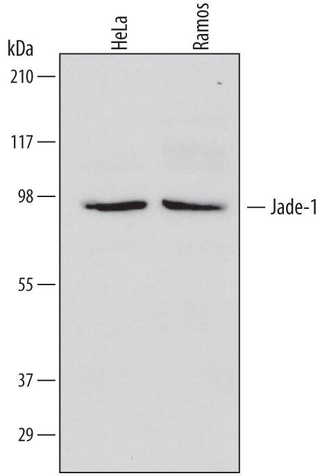 Detection of Human Jade-1/PHF17 antibody by Western Blot.