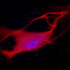 Jagged 2 antibody in HUVEC Human Cells by Immunocytochemistry (ICC).