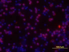 Jak1 antibody in Mouse Splenocytes by Immunocytochemistry (ICC).