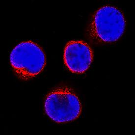 Jak3 antibody in Jurkat Human Cell Line by Immunocytochemistry (ICC).