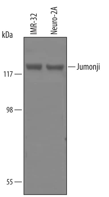 Detection of Human Jumonji/JARID2 antibody by Western Blot.