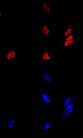 Jumonji/JARID2 antibody in LNCaP Human Cell Line by Immunocytochemistry (ICC).