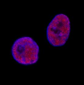 KAP1 antibody in Neuro-2A Mouse Cell Line by Immunocytochemistry (ICC).