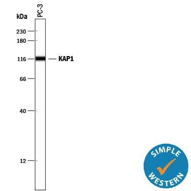 Detection of Human KAP1 antibody by Simple WesternTM.