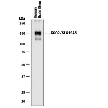 Detection of Human KCC2/SLC12A5 antibody by Western Blot.