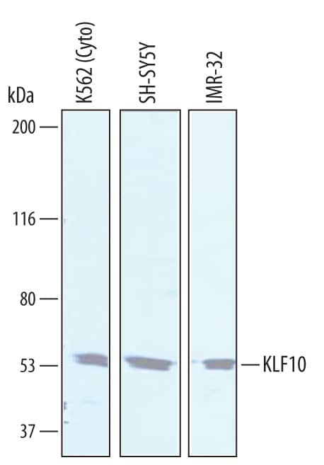 Detection of Human KLF10 antibody by Western Blot.