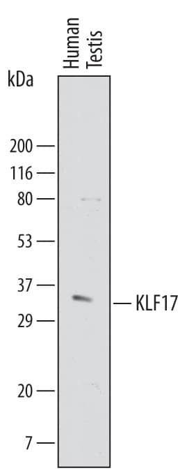 Detection of Human KLF17 antibody by Western Blot.