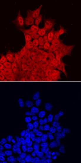 KLF5 antibody in D3 Mouse Stem Cells by Immunocytochemistry (ICC).