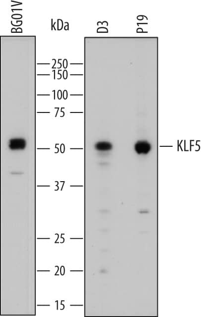 Detection of Human and Mouse KLF5 antibody by Western Blot.