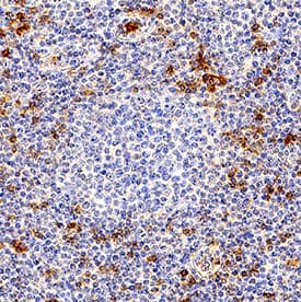 KLRG1 antibody in Human Tonsil by Immunohistochemistry (IHC-P).
