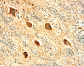 KOR antibody in Human Brainstem by Immunohistochemistry (IHC-P).