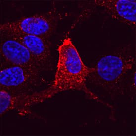 KOR antibody in CHO Chinese Hamster Cell Line by Immunocytochemistry (ICC).