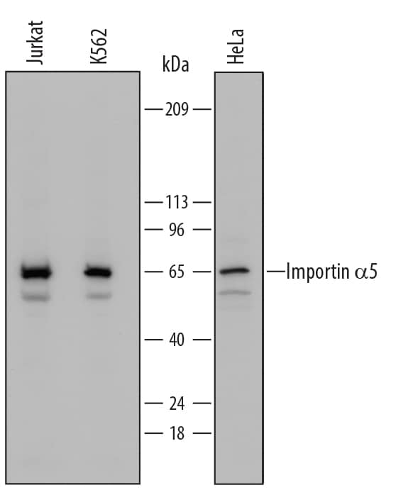 Detection of Human Importin a5/KPNA1 antibody by Western Blot.