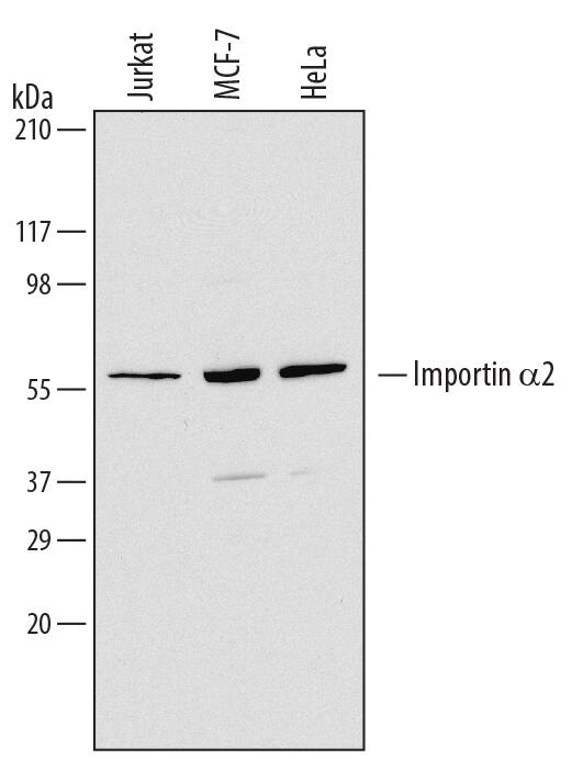 Detection of Human Importin a2/KPNA2 antibody by Western Blot.