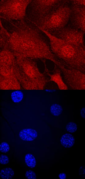 Importin a2/KPNA2 antibody in NTera-2 Human Cell Line by Immunocytochemistry (ICC).