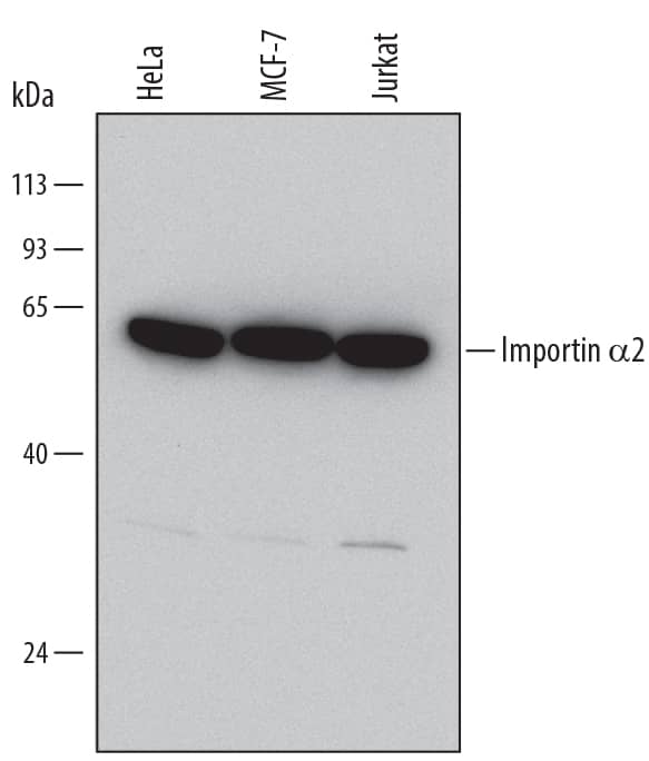 Detection of Human Importin a2/KPNA2 antibody by Western Blot.