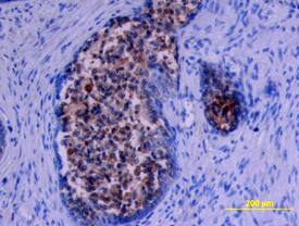 Kallikrein 11 antibody in Human Prostate by Immunohistochemistry (IHC-P).