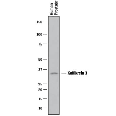 Detection of Human Kallikrein 3/PSA antibody by Western Blot.