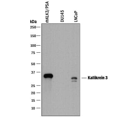 Detection of Human Kallikrein 3/PSA antibody by Western Blot.