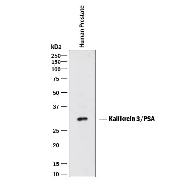 Detection of Human Kallikrein 3/PSA antibody by Western Blot.