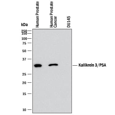 Detection of Human Kallikrein 3/PSA antibody by Western Blot.